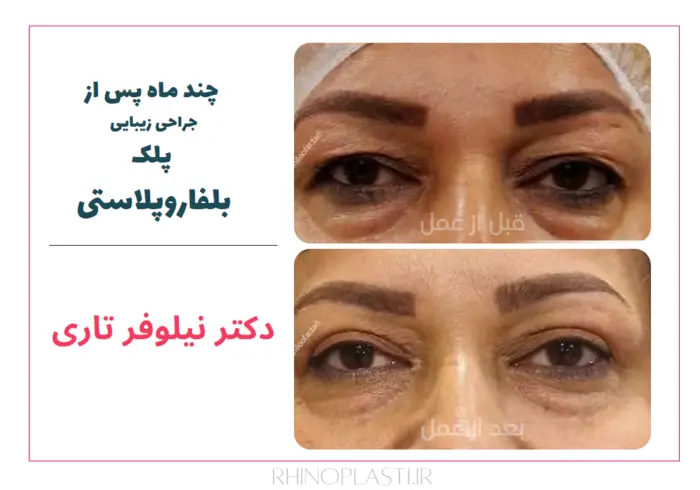 تصاویر جراحی دکتر نیلوفر تاری