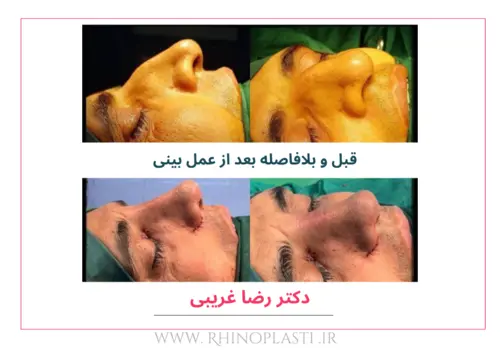 تصاویر جراحی دکتر رضا غریبی