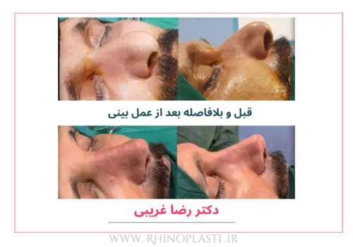 تصاویر گالری بیماران دکتر رضا غریبی