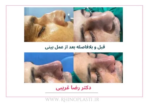 تصاویر گالری بیماران دکتر رضا غریبی