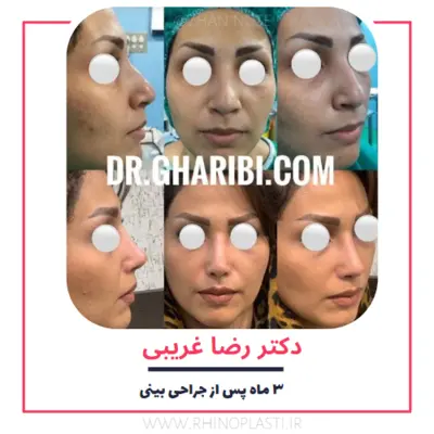 تصاویر گالری بیماران دکتر رضا غریبی