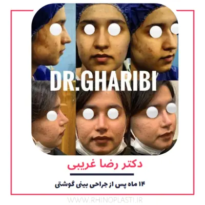 تصاویر گالری بیماران دکتر رضا غریبی