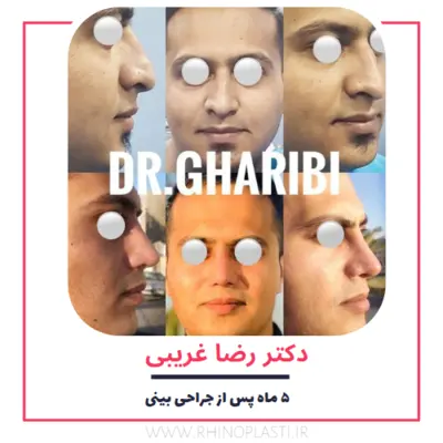 تصاویر گالری بیماران دکتر رضا غریبی