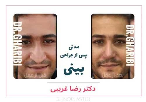 رضایت بیماران دکتر رضا غریبی