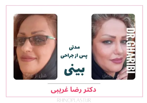 رضایت بیماران دکتر رضا غریبی