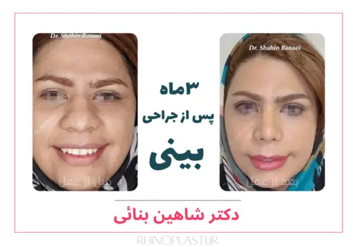 تصاویر جراحی دکتر شاهین بنایی