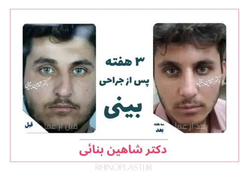 تصاویر جراحی دکتر شاهین بنایی