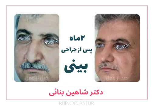 تصاویر جراحی دکتر شاهین بنایی