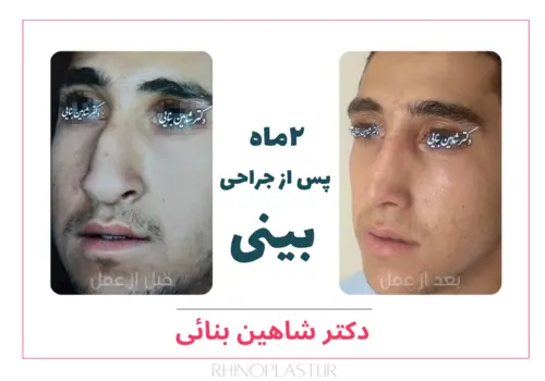 تصاویر جراحی دکتر شاهین بنایی