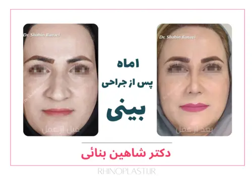 تصاویر جراحی دکتر شاهین بنایی