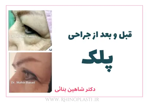 تصاویر جراحی دکتر شاهین بنایی
