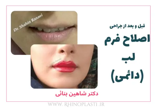 تصاویر جراحی دکتر شاهین بنایی