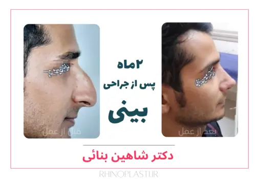 تصاویر گالری بیماران دکتر شاهین بنایی
