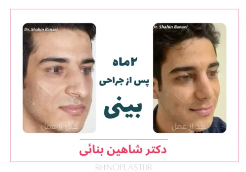 تصاویر گالری بیماران دکتر شاهین بنایی