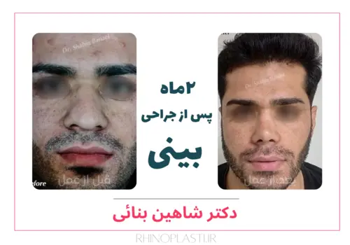 تصاویر گالری بیماران دکتر شاهین بنایی