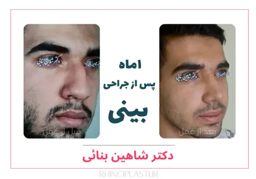 تصاویر گالری بیماران دکتر شاهین بنایی