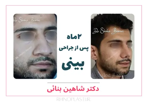 تصاویر گالری بیماران دکتر شاهین بنایی