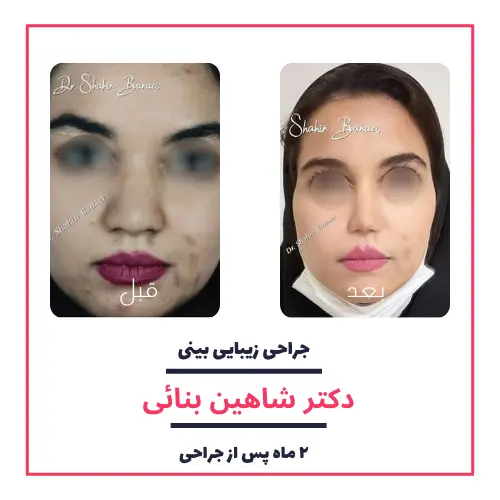 تصاویر گالری بیماران دکتر شاهین بنایی