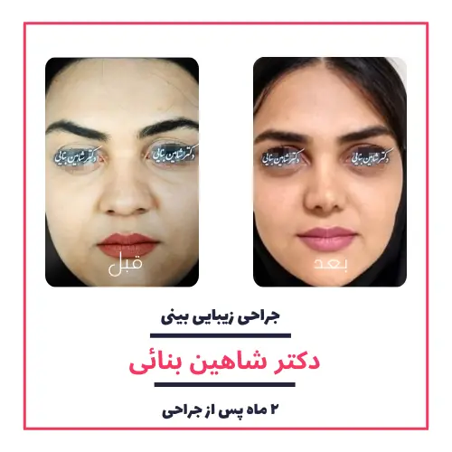 تصاویر گالری بیماران دکتر شاهین بنایی