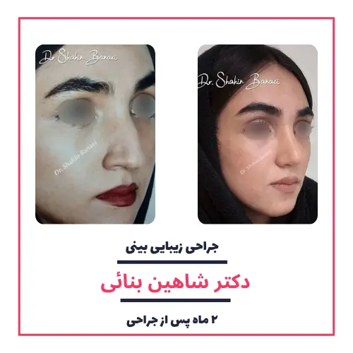 تصاویر گالری بیماران دکتر شاهین بنایی