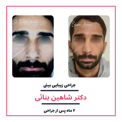 تصاویر گالری بیماران دکتر شاهین بنایی