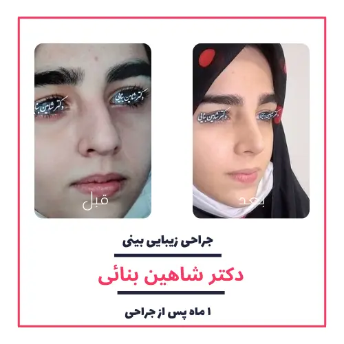 تصاویر گالری بیماران دکتر شاهین بنایی