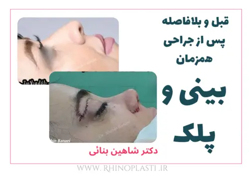 تصاویر گالری بیماران دکتر شاهین بنایی