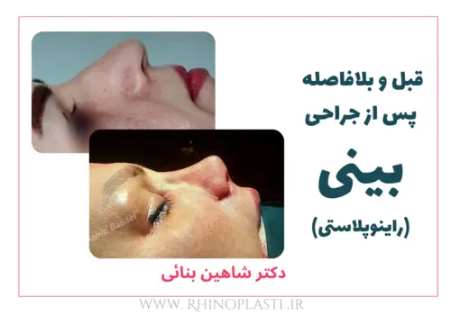 تصاویر گالری بیماران دکتر شاهین بنایی