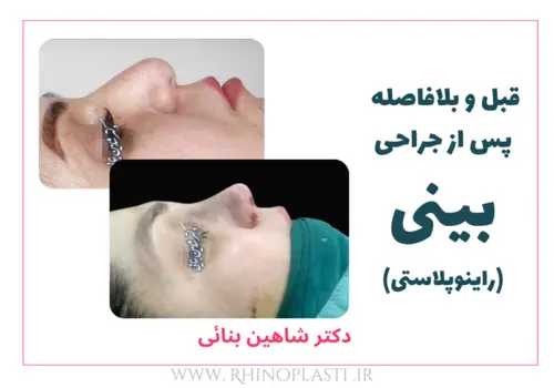 تصاویر گالری بیماران دکتر شاهین بنایی