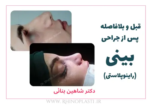 تصاویر گالری بیماران دکتر شاهین بنایی