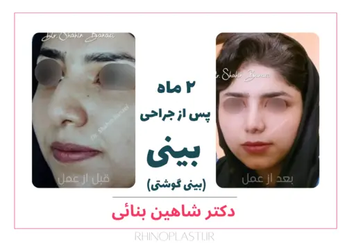 تصاویر گالری بیماران دکتر شاهین بنایی