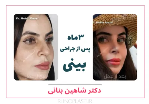 تصاویر گالری بیماران دکتر شاهین بنایی