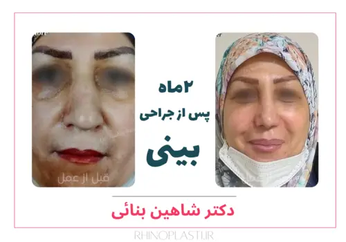 تصاویر گالری بیماران دکتر شاهین بنایی