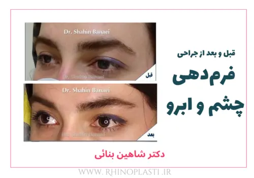 تصاویر گالری بیماران دکتر شاهین بنایی