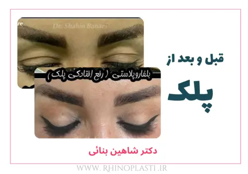 تصاویر گالری بیماران دکتر شاهین بنایی
