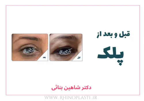 تصاویر گالری بیماران دکتر شاهین بنایی