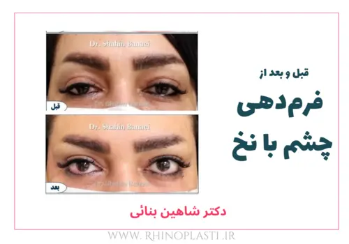تصاویر گالری بیماران دکتر شاهین بنایی