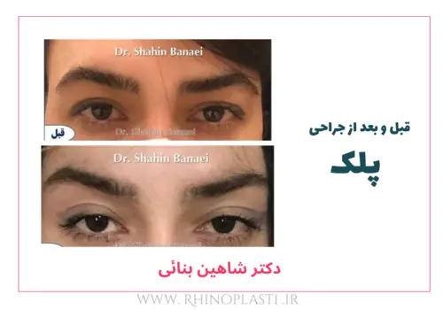 تصاویر گالری بیماران دکتر شاهین بنایی