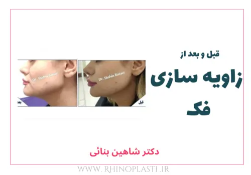 تصاویر گالری بیماران دکتر شاهین بنایی