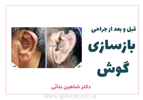 تصاویر گالری بیماران دکتر شاهین بنایی