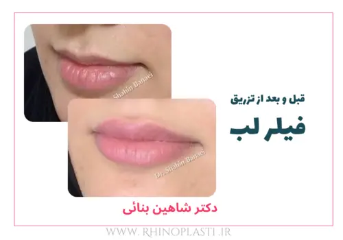 تصاویر گالری بیماران دکتر شاهین بنایی