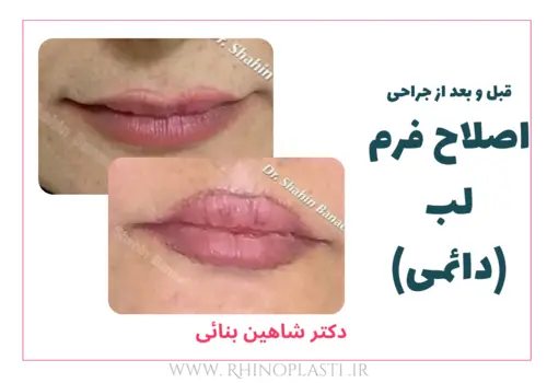 تصاویر گالری بیماران دکتر شاهین بنایی