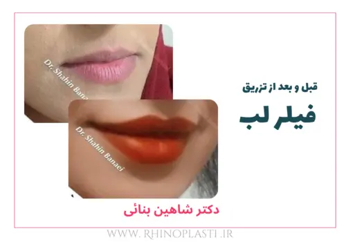 تصاویر گالری بیماران دکتر شاهین بنایی